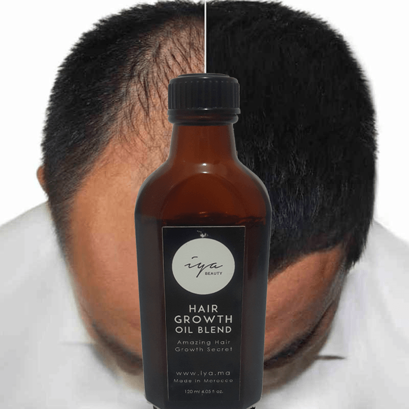 زيت حبة البركة والزيوت السبعة